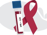 Яр Чаллыда ВИЧка түләүсез тест үткәрү буенча акция узачак